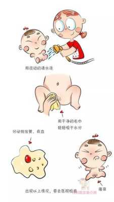 孕期能用盐水洗外阴吗 第2张 孕期能用盐水洗外阴吗 第2张