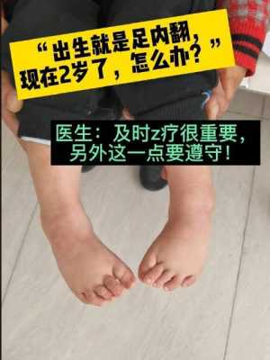 胎儿左足内翻(宝宝脚内翻怎么回事) 第1张 胎儿左足内翻(宝宝脚内翻怎么回事) 第1张