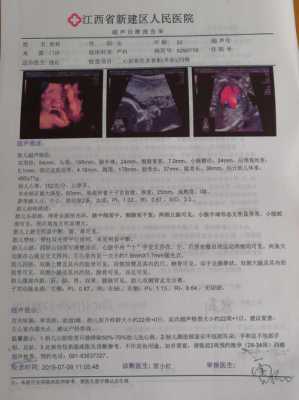 胎儿左心室有强光斑(怀孕28周四维左心室强光斑胎儿肠管稍增强严重吗) 第2张 胎儿左心室有强光斑(怀孕28周四维左心室强光斑胎儿肠管稍增强严重吗) 第2张