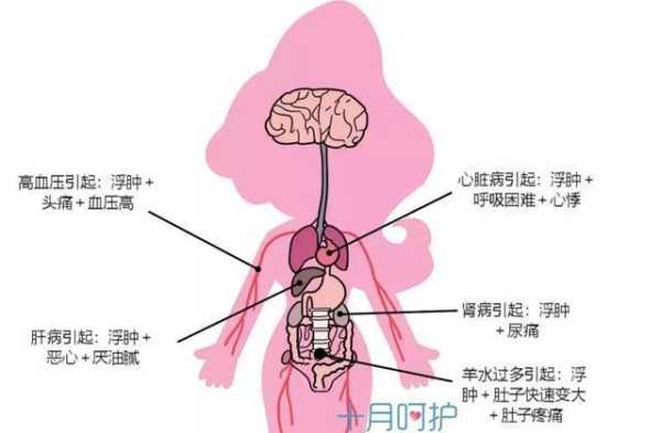孕期水肿对胎儿的影响(孕期水肿对胎儿的影响有哪些) 第1张 孕期水肿对胎儿的影响(孕期水肿对胎儿的影响有哪些) 第1张
