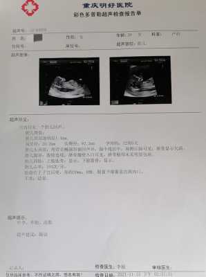 孕期两个月出血(怀孕两个月上大号流血是什么原因) 第1张 孕期两个月出血(怀孕两个月上大号流血是什么原因) 第1张