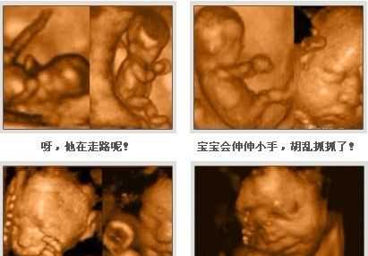 孕妇产检期间需要做几次四维彩超,整个孕期要做几次四维彩超 第2张 孕妇产检期间需要做几次四维彩超,整个孕期要做几次四维彩超 第2张