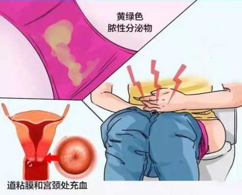 有滴虫严重吗滴虫是什么会有什么影响啊,孕妇滴虫会传染胎儿吗图片 第2张 有滴虫严重吗滴虫是什么会有什么影响啊,孕妇滴虫会传染胎儿吗图片 第2张