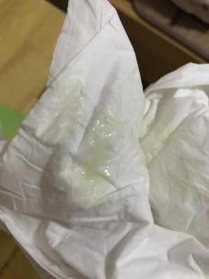 孕期水样白带是怎么回事(为什么白带像水一样流着的呢,孕妇这样的症状是羊水破了吗,怎么办啊) 第1张 孕期水样白带是怎么回事(为什么白带像水一样流着的呢,孕妇这样的症状是羊水破了吗,怎么办啊) 第1张