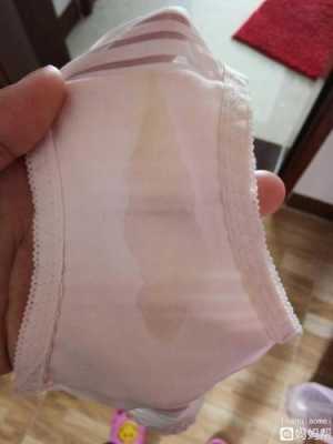孕期水样白带是怎么回事(为什么白带像水一样流着的呢,孕妇这样的症状是羊水破了吗,怎么办啊) 第3张 孕期水样白带是怎么回事(为什么白带像水一样流着的呢,孕妇这样的症状是羊水破了吗,怎么办啊) 第3张