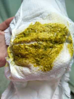 六个多月胎儿图片(6个月小孩一直拉肚子,化验大便正常是怎么回事) 第2张 六个多月胎儿图片(6个月小孩一直拉肚子,化验大便正常是怎么回事) 第2张