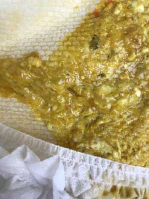 六个多月胎儿图片(6个月小孩一直拉肚子,化验大便正常是怎么回事) 第3张 六个多月胎儿图片(6个月小孩一直拉肚子,化验大便正常是怎么回事) 第3张