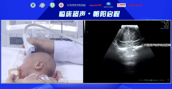 新生儿做了头颅彩超会有什么影响吗？就怕辐射会很厉害的,胎儿检测查的是什么项目  第1张