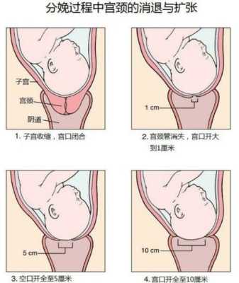 胎儿进入产道多久会生(胎儿进入产道多久会生产) 第3张 胎儿进入产道多久会生(胎儿进入产道多久会生产) 第3张