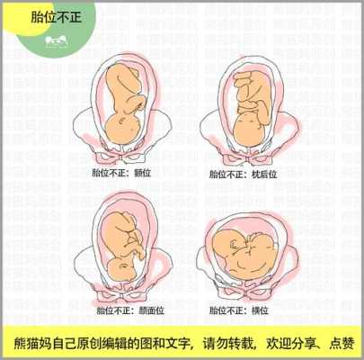 入盆后胎儿的姿势(入盆后胎儿的姿势有哪些) 第3张 入盆后胎儿的姿势(入盆后胎儿的姿势有哪些) 第3张