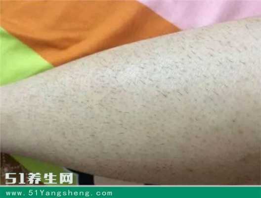 孕期体毛变少已知是男（男性彻底女性化后会变成女生吗）  第1张