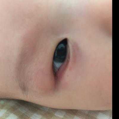 7个月宝宝眼睛周围总起红疙瘩是怎么了,七个多月胎儿图片 第2张 7个月宝宝眼睛周围总起红疙瘩是怎么了,七个多月胎儿图片 第2张