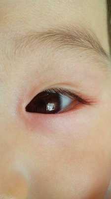 7个月宝宝眼睛周围总起红疙瘩是怎么了,七个多月胎儿图片 第1张 7个月宝宝眼睛周围总起红疙瘩是怎么了,七个多月胎儿图片 第1张