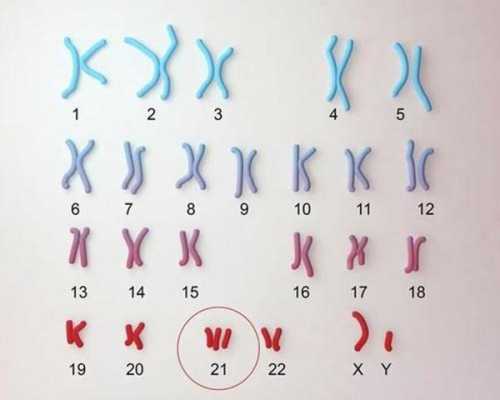 孕期染色体检查是什么(胎儿染色体检查什么) 第1张 孕期染色体检查是什么(胎儿染色体检查什么) 第1张