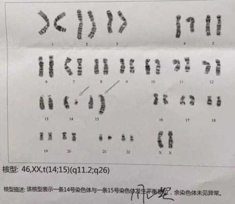 孕期染色体检查是什么(胎儿染色体检查什么) 第2张 孕期染色体检查是什么(胎儿染色体检查什么) 第2张