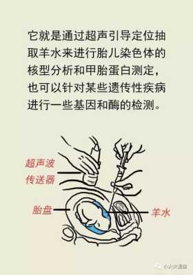 胎儿偏小较多需要做羊水穿刺吗,羊水少会导致胎儿偏小吗怎么办 第1张 胎儿偏小较多需要做羊水穿刺吗,羊水少会导致胎儿偏小吗怎么办 第1张