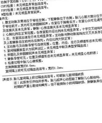 胎儿侧脑室宽度正常值是多少,胎儿右侧脑室后角宽正常值 第2张 胎儿侧脑室宽度正常值是多少,胎儿右侧脑室后角宽正常值 第2张