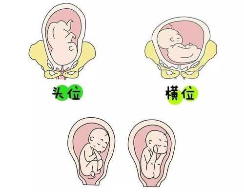 什么是胎儿打嗝?胎儿打嗝是什么感觉,胎儿打嗝是哪个部位在动 第1张 什么是胎儿打嗝?胎儿打嗝是什么感觉,胎儿打嗝是哪个部位在动 第1张