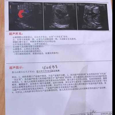 心脏彩超对胎儿的影响(孕期心脏彩超有必要做吗) 第3张 心脏彩超对胎儿的影响(孕期心脏彩超有必要做吗) 第3张