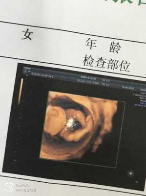 4个月大的胎儿(4个月宝宝可以坐着吗?宝宝多大可以坐) 第2张 4个月大的胎儿(4个月宝宝可以坐着吗?宝宝多大可以坐) 第2张