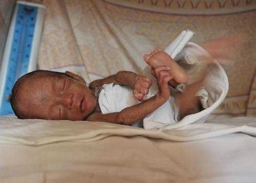 三十五周胎儿能存活吗（早产儿智力会有影响吗）  第1张
