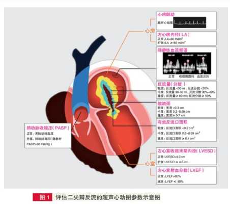 胎儿二尖瓣反流(胎儿二尖瓣反流是什么意思) 第1张 胎儿二尖瓣反流(胎儿二尖瓣反流是什么意思) 第1张