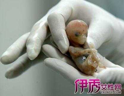 三个半月胎儿高清图片(三个半月胎儿高清图片 男孩) 第1张 三个半月胎儿高清图片(三个半月胎儿高清图片 男孩) 第1张