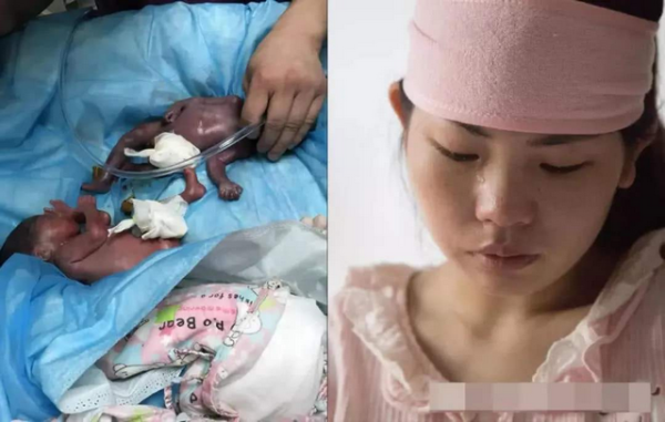 孕二十五周胎儿发育情况(怀了25周的胎儿,如果这时候出生的话,宝宝可以存活下来吗) 第2张 孕二十五周胎儿发育情况(怀了25周的胎儿,如果这时候出生的话,宝宝可以存活下来吗) 第2张