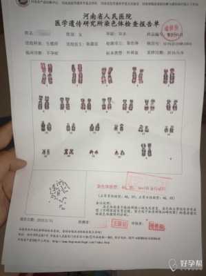 孕妇检查染色体过高有什么问题,胎儿染色体多一条是什么原因造成的 第1张 孕妇检查染色体过高有什么问题,胎儿染色体多一条是什么原因造成的 第1张