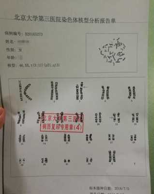 孕妇检查染色体过高有什么问题,胎儿染色体多一条是什么原因造成的 第3张 孕妇检查染色体过高有什么问题,胎儿染色体多一条是什么原因造成的 第3张