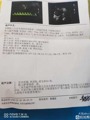 胎儿超声四项生物物理评分(胎儿超声四项生物物理评分8分) 第2张 胎儿超声四项生物物理评分(胎儿超声四项生物物理评分8分) 第2张
