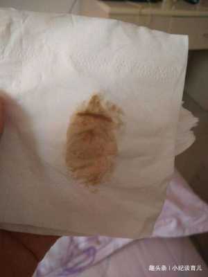孕期有褐色分泌物怎么回事,孕期分泌褐色分泌物是什么时候 第2张 孕期有褐色分泌物怎么回事,孕期分泌褐色分泌物是什么时候 第2张