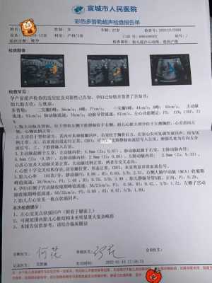 胎儿心脏彩超什么时候做最好(胎儿心脏彩超什么时候做最好呢) 第1张 胎儿心脏彩超什么时候做最好(胎儿心脏彩超什么时候做最好呢) 第1张