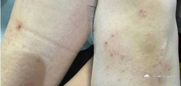 孕期流咖啡色分泌物（孕期流咖啡色分泌物是流血吗）  第3张