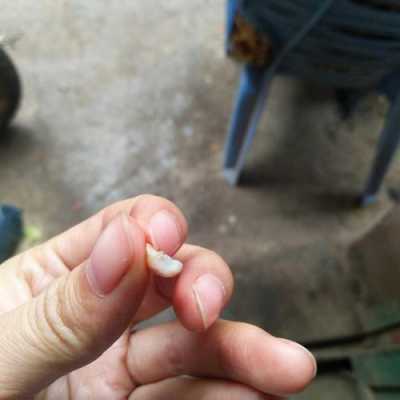 怀孕期间牙齿掉了一半(怀孕期间牙齿掉了一半的原因) 第3张 怀孕期间牙齿掉了一半(怀孕期间牙齿掉了一半的原因) 第3张