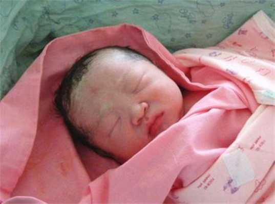 为什么有的婴儿一出生就有鼻梁,胎儿没鼻梁骨说明孩子痴呆 第3张 为什么有的婴儿一出生就有鼻梁,胎儿没鼻梁骨说明孩子痴呆 第3张