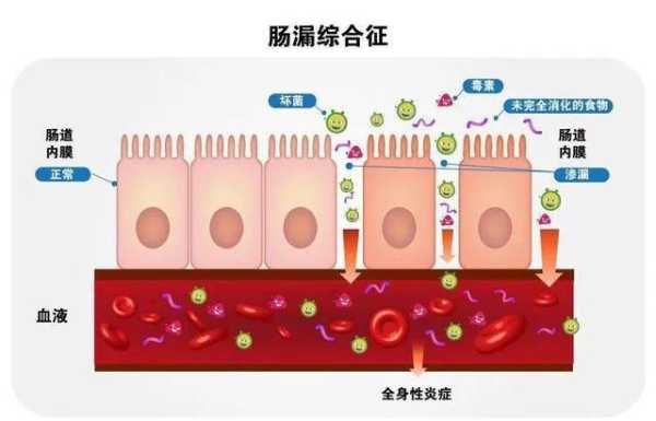 肠上皮的结构特点,胎儿肠外漏导致原因 第3张 肠上皮的结构特点,胎儿肠外漏导致原因 第3张