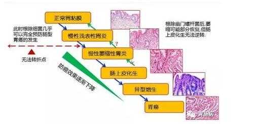 肠上皮的结构特点,胎儿肠外漏导致原因 第2张 肠上皮的结构特点,胎儿肠外漏导致原因 第2张