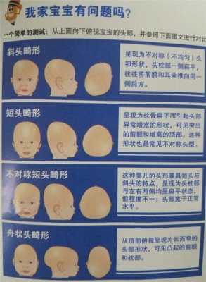 胎儿颅骨畸形(胎儿颅骨畸形的原因) 第2张 胎儿颅骨畸形(胎儿颅骨畸形的原因) 第2张