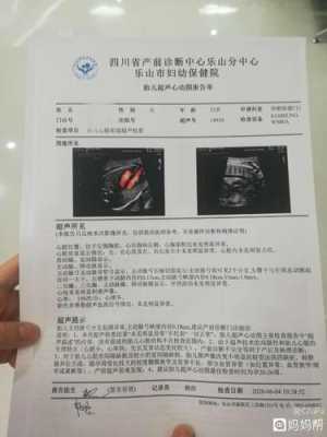 胎儿心脏间隙(胎儿心脏间隙大是什么原因) 第3张 胎儿心脏间隙(胎儿心脏间隙大是什么原因) 第3张
