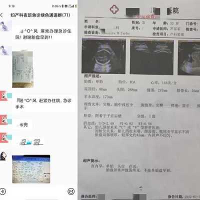 b超体重跟胎儿实际体重相差多少,怎么推算胎儿体重  第2张
