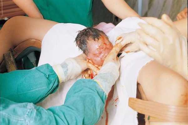 顺产产妇第一次大便方法,胎儿怎么拉屎撒尿 第1张 顺产产妇第一次大便方法,胎儿怎么拉屎撒尿 第1张