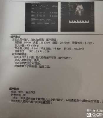 胎儿腿短是怎么回事?怎么补救啊,胎儿发育腿短什么原因 第1张 胎儿腿短是怎么回事?怎么补救啊,胎儿发育腿短什么原因 第1张