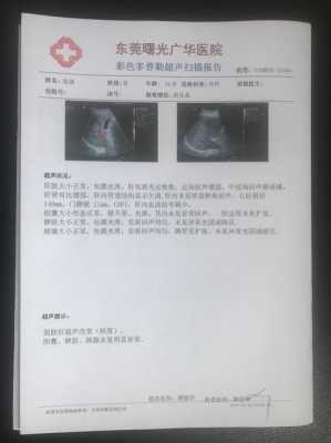 胎儿脾超声(肝胆胰脾肾彩超需要空腹吗) 第2张 胎儿脾超声(肝胆胰脾肾彩超需要空腹吗) 第2张