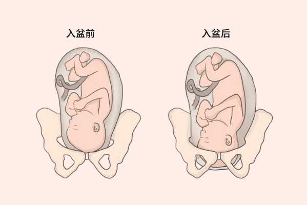 胎头衔接的标准,胎儿未衔接是什么意思 第2张 胎头衔接的标准,胎儿未衔接是什么意思 第2张