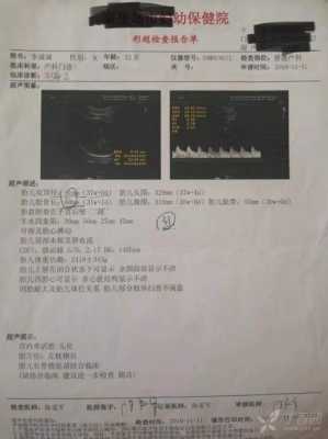 胎儿发育头大(胎儿发育头大腿短是什么原因) 第2张 胎儿发育头大(胎儿发育头大腿短是什么原因) 第2张