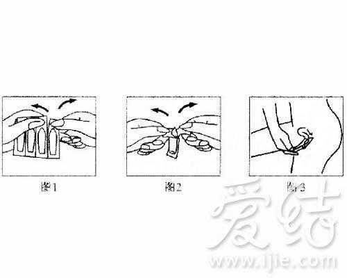 怀孕期间能治疗阴道炎吗(怀孕期间霉菌性阴道炎怎么治疗) 第1张 怀孕期间能治疗阴道炎吗(怀孕期间霉菌性阴道炎怎么治疗) 第1张
