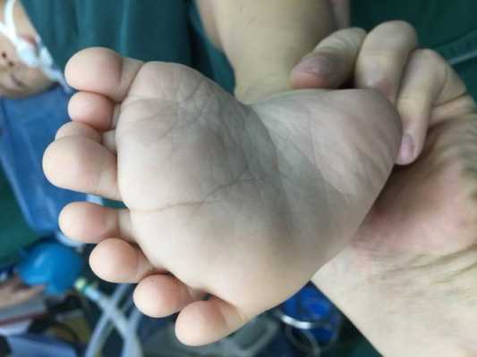 胎儿多脚趾(孩子脚趾遗传爸爸还是妈妈) 第2张 胎儿多脚趾(孩子脚趾遗传爸爸还是妈妈) 第2张