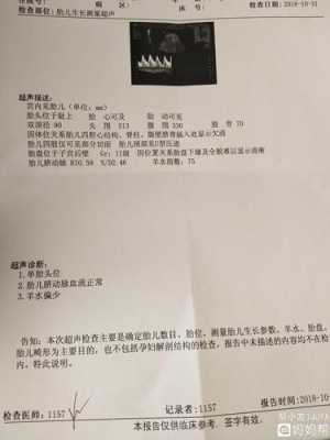 产检本,衔接一栏,写着平,这个是什么意思,胎儿衔接定是什么意思 第3张 产检本,衔接一栏,写着平,这个是什么意思,胎儿衔接定是什么意思 第3张