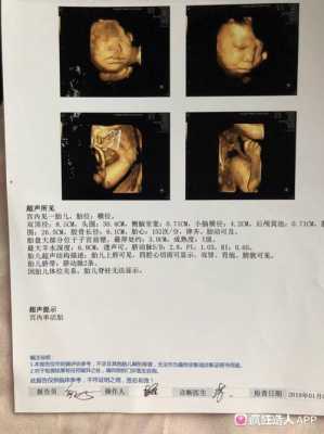 产检胎儿偏大(产检胎儿偏大一周正常吗) 第2张 产检胎儿偏大(产检胎儿偏大一周正常吗) 第2张